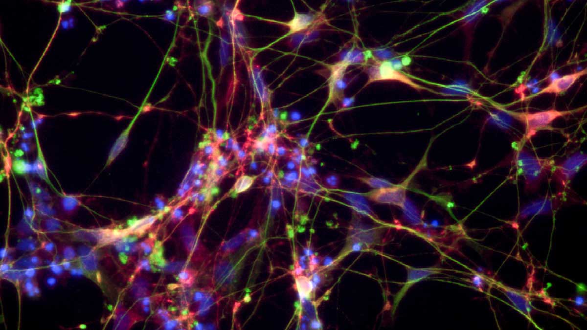 MULTISPECIES STEM CELL DIFFERENTIATION TO NEURONS, LIVER & HEART CELLS